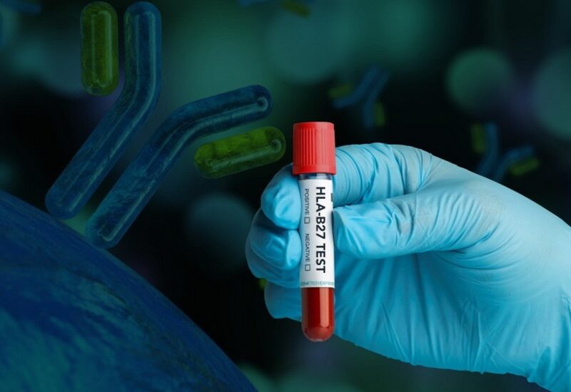 HLA tipizacija tkiva dostupna u Republici Srpskoj